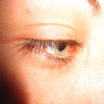 Daydreaming