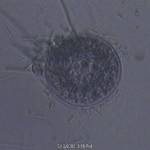 Arcella Feeding
