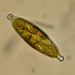 Diatom 11_30