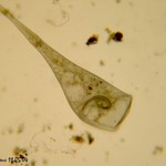 Stentor igneus 1